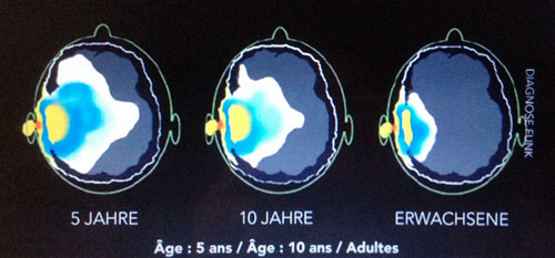 Ondes & Prévention - Rapport Bioinitiative